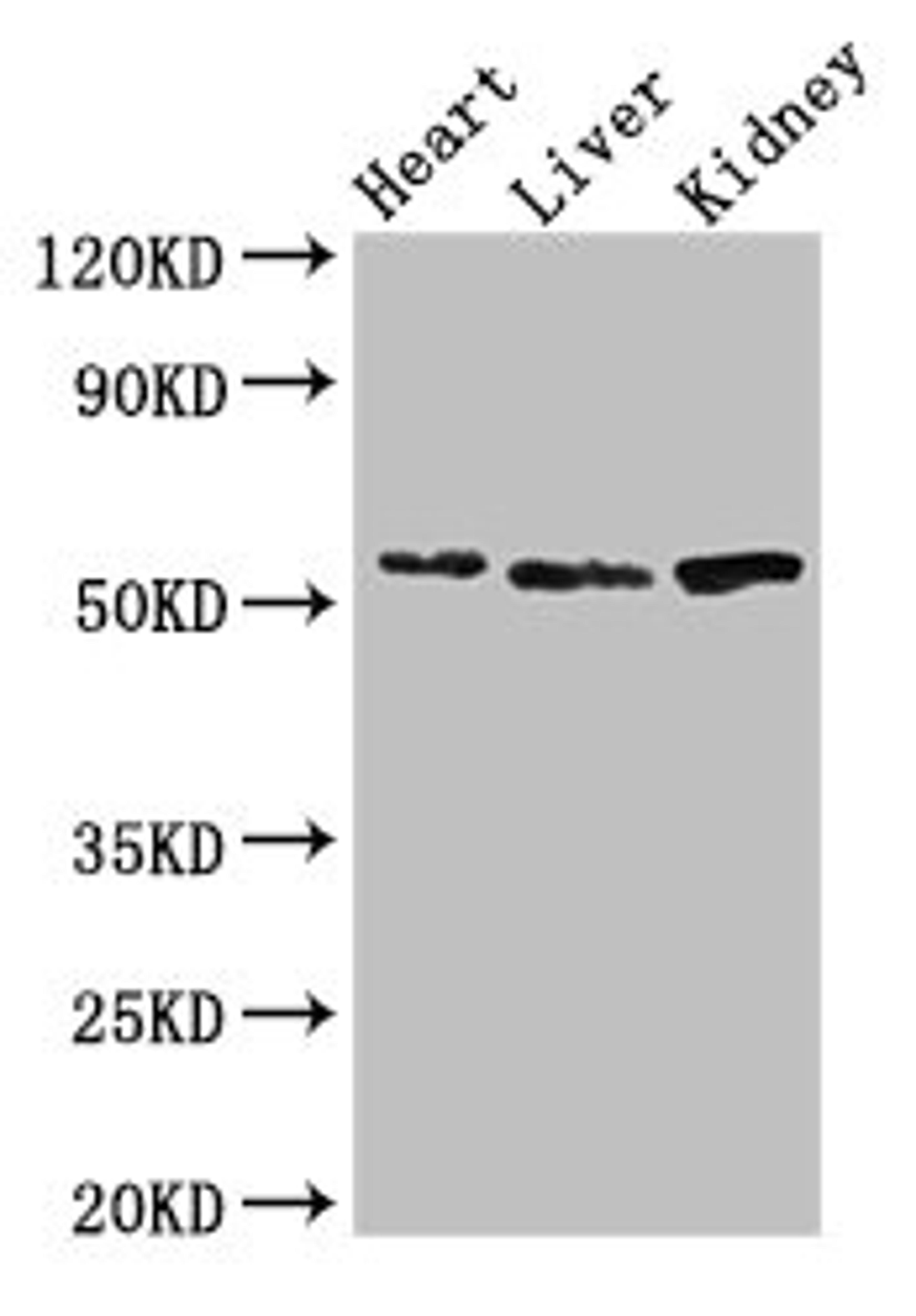 Western Blot. Positive WB detected in: Mouse heart tissue, Mouse liver tissue, Mouse kidney tissue. All lanes: SOX9 antibody at 3ug/ml. Secondary. Goat polyclonal to rabbit IgG at 1/50000 dilution. Predicted band size: 57 kDa. Observed band size: 57 kDa. 