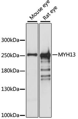 Western blot - MYH13 antibody (A14620)