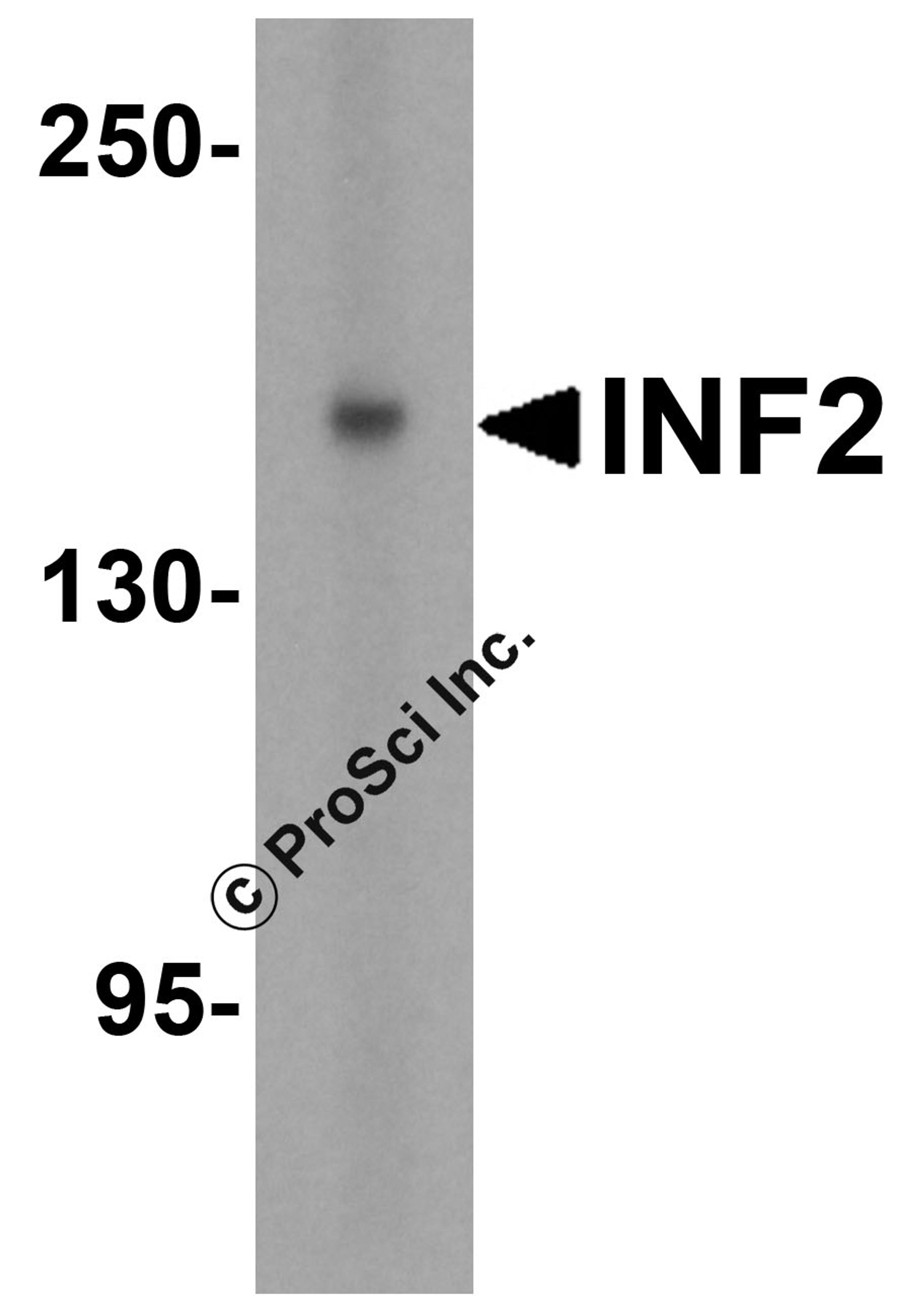Western blot analysis of INF2 in (A) human tonsil and (B) rat stomach tissue lysate with INF2 antibody at 1 μg/mL.