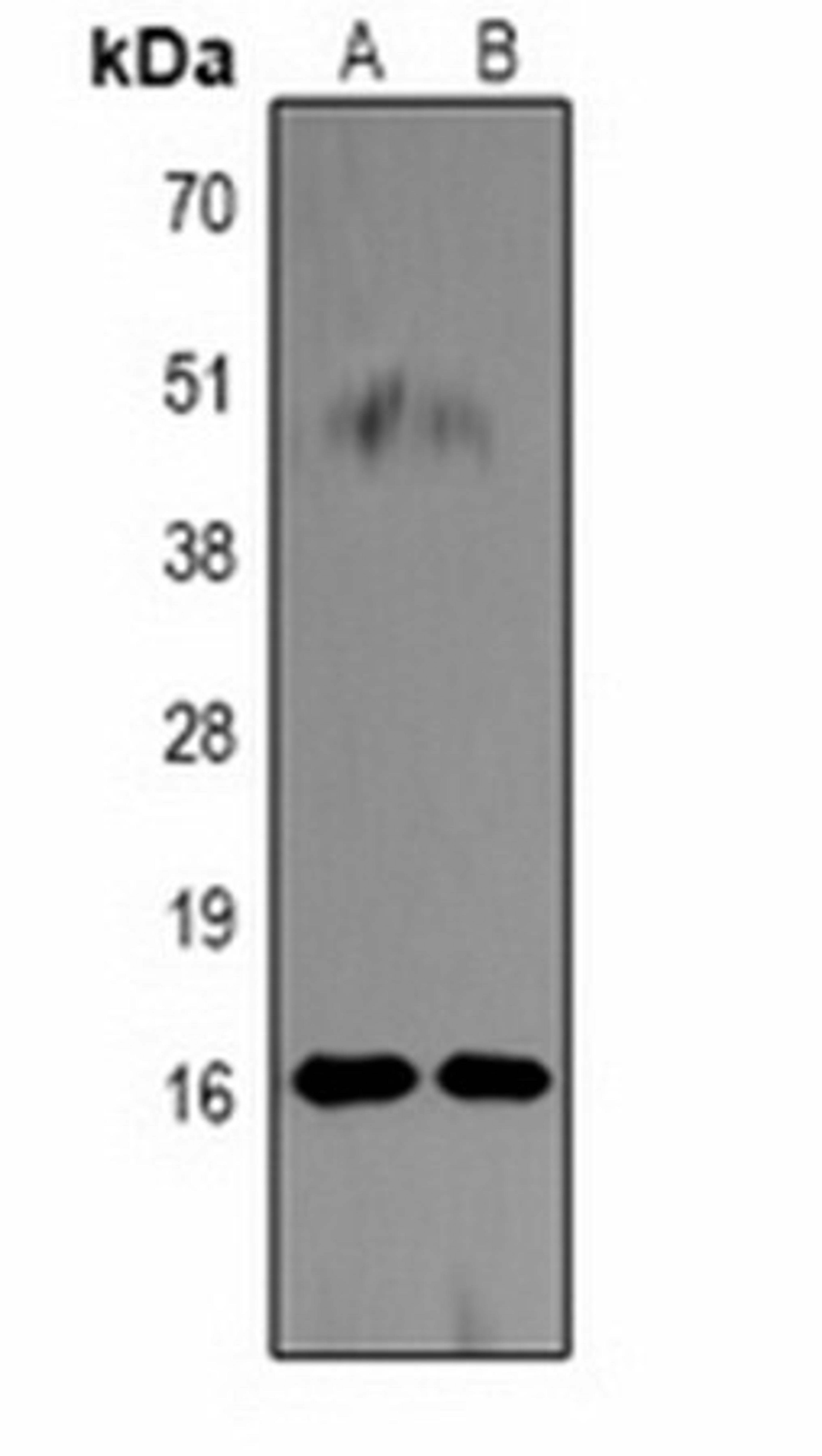 Western blot analysis of  Hela (Lane1), NIH3T3 (Lane2) whole cell lysates using Histone H3 (Citruline R26) antibody