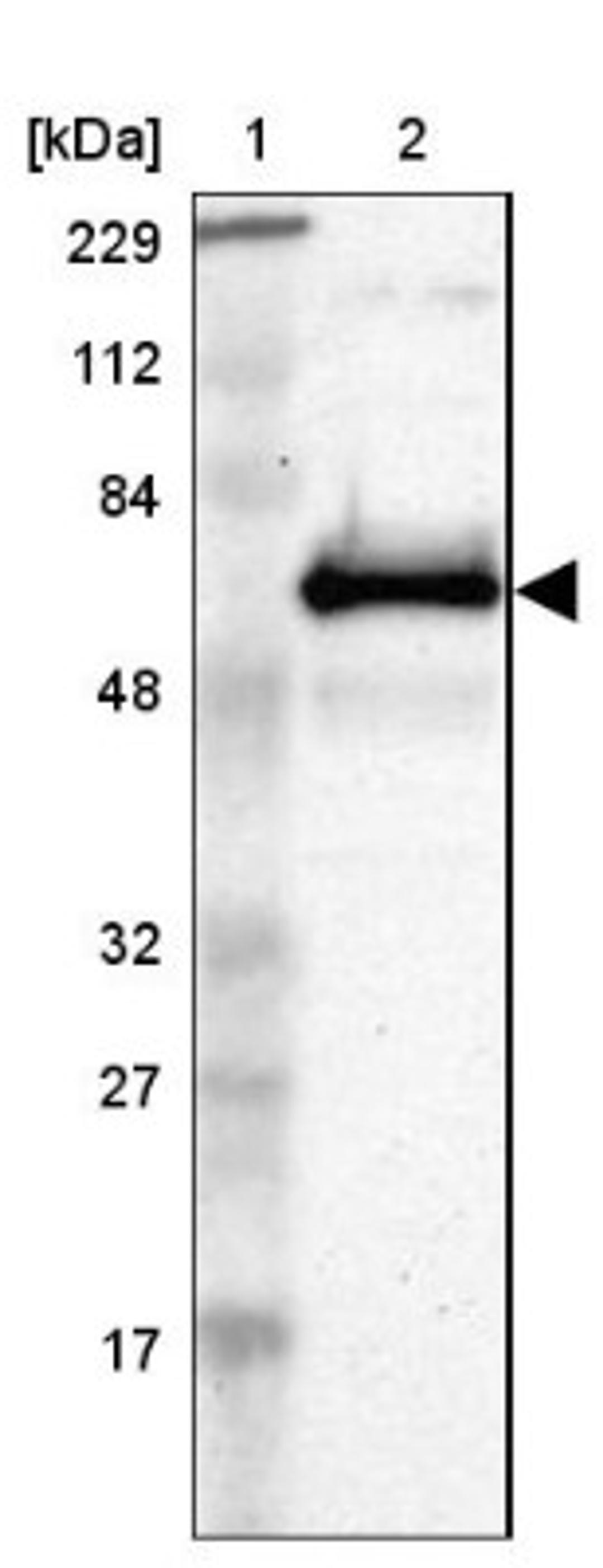 Western Blot: ETV3 Antibody [NBP1-80931] - Lane 1: Marker [kDa] 229, 112, 84, 48, 32, 27, 17<br/>Lane 2: Human cell line RT-4