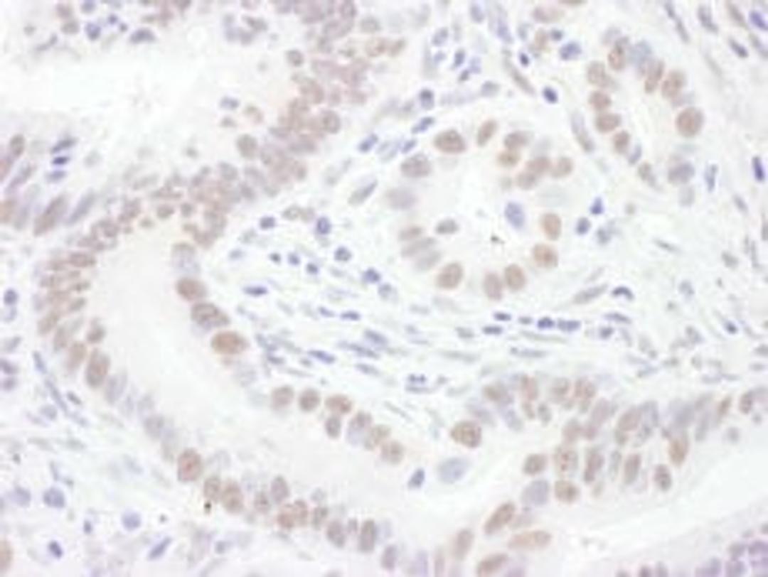 Detection of human Sm-D3 by immunohistochemistry.