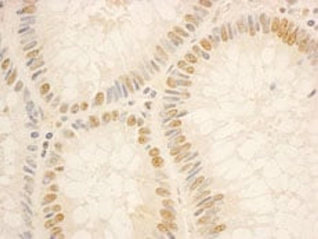 Detection of human NOP56 by immunohistochemistry.