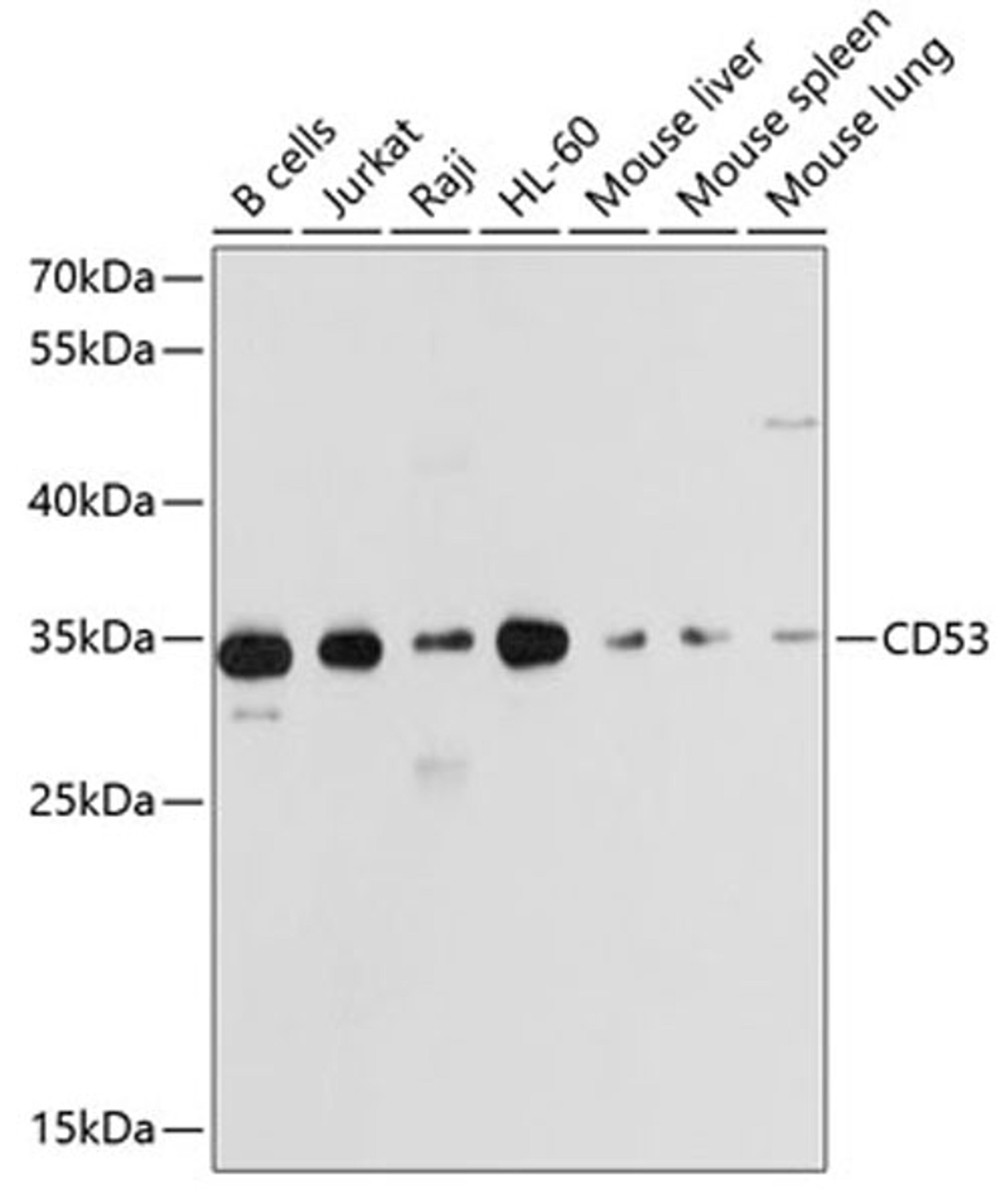 Western blot - CD53 antibody (A10079)