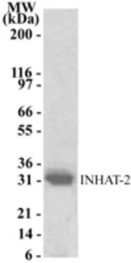 Western Blot: INHAT-2 Antibody [NB100-56619] - Detection of INHAT-2 using this antibody at a 1:1000 dilution against 10 ug of HeLa cell lysate.