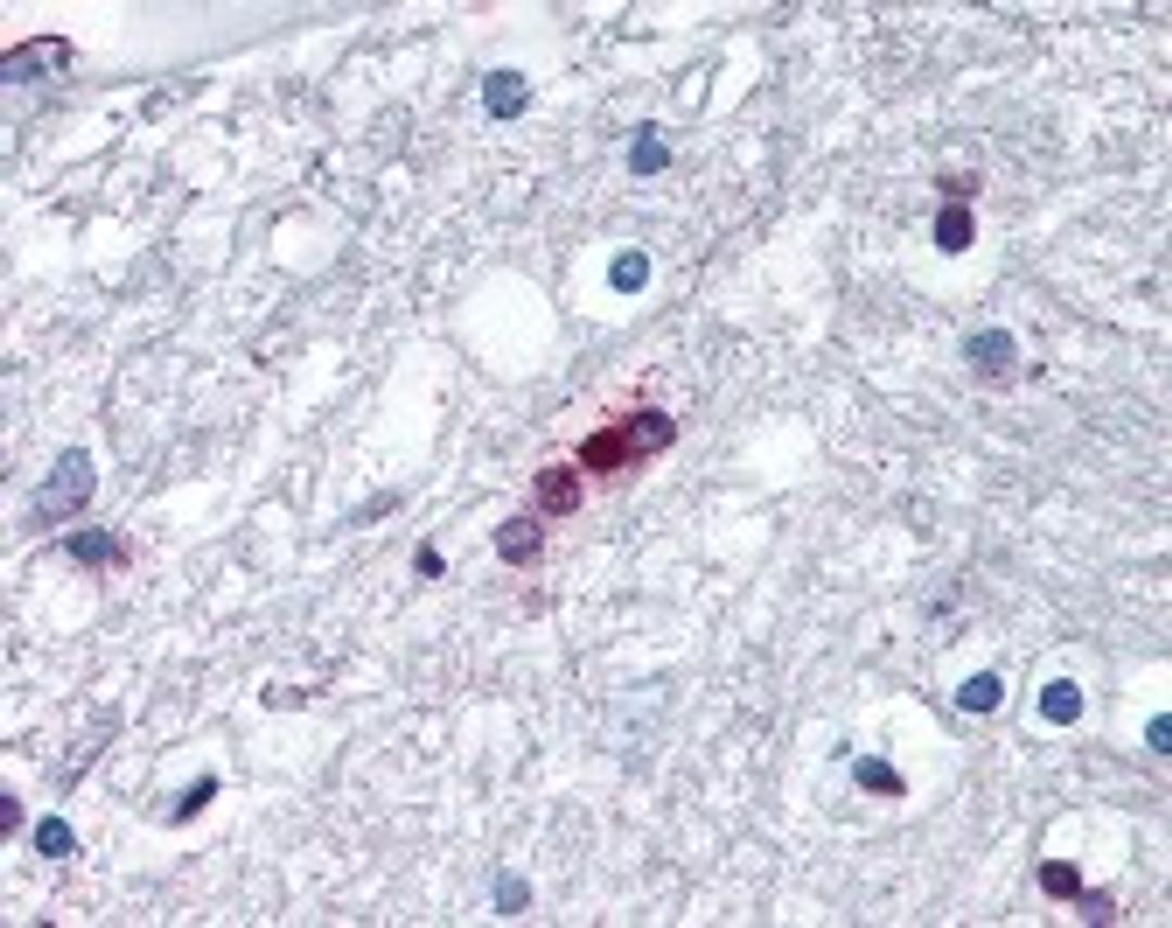 Immunohistochemistry staining of Myelin Basic Protein in brain, oligodendrocytes tissue using Myelin Basic Protein Monoclonal Antibody.