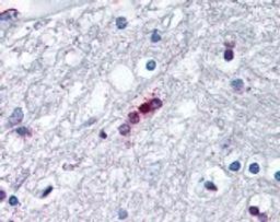 Immunohistochemistry staining of Myelin Basic Protein in brain, oligodendrocytes tissue using Myelin Basic Protein Monoclonal Antibody.