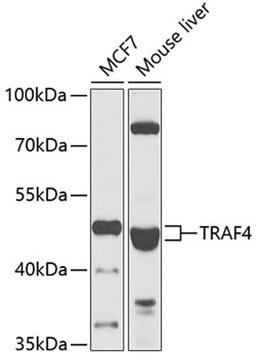 Western blot - TRAF4 antibody (A7047)