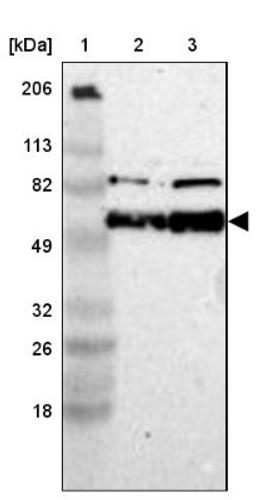 Western Blot: SNTB2 Antibody [NBP1-85343] - Lane 1: Marker [kDa] 206, 113, 82, 49, 32, 26, 18<br/>Lane 2: Human cell line RT-4<br/>Lane 3: Human cell line U-251MG sp