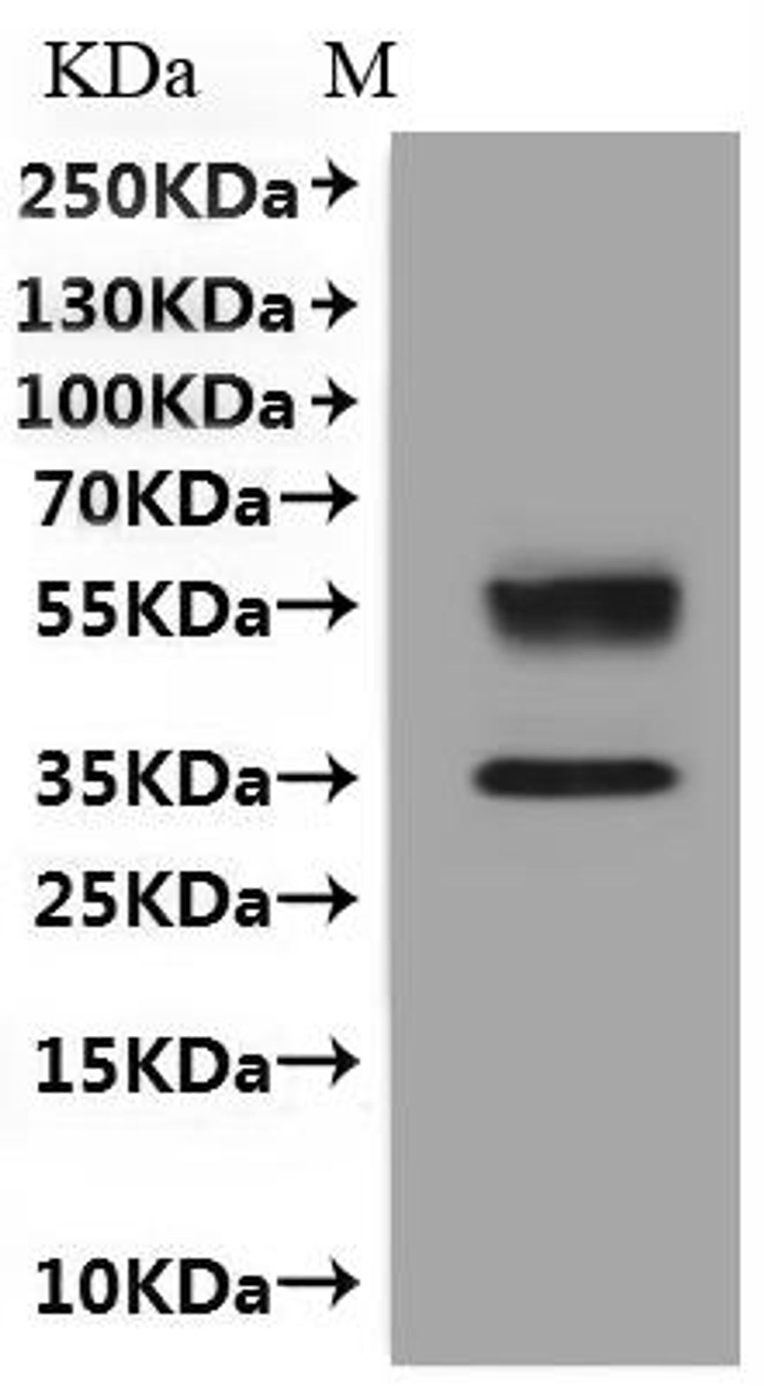 CSB-MP006256HU is detected by Mouse anti-6*His monoclonal antibody.