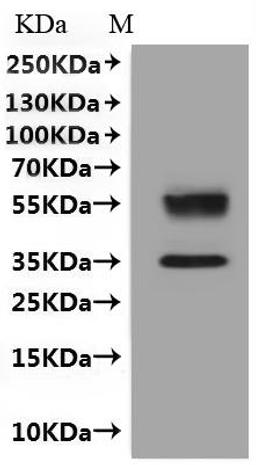 CSB-MP006256HU is detected by Mouse anti-6*His monoclonal antibody.