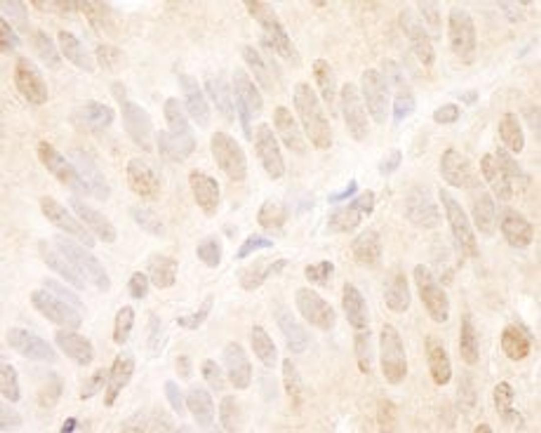 Detection of human TCF12 by immunohistochemistry.