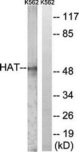 Western blot analysis of extracts from LOVO cells using HAT antibody (right lane: addition of synthetic peptide)