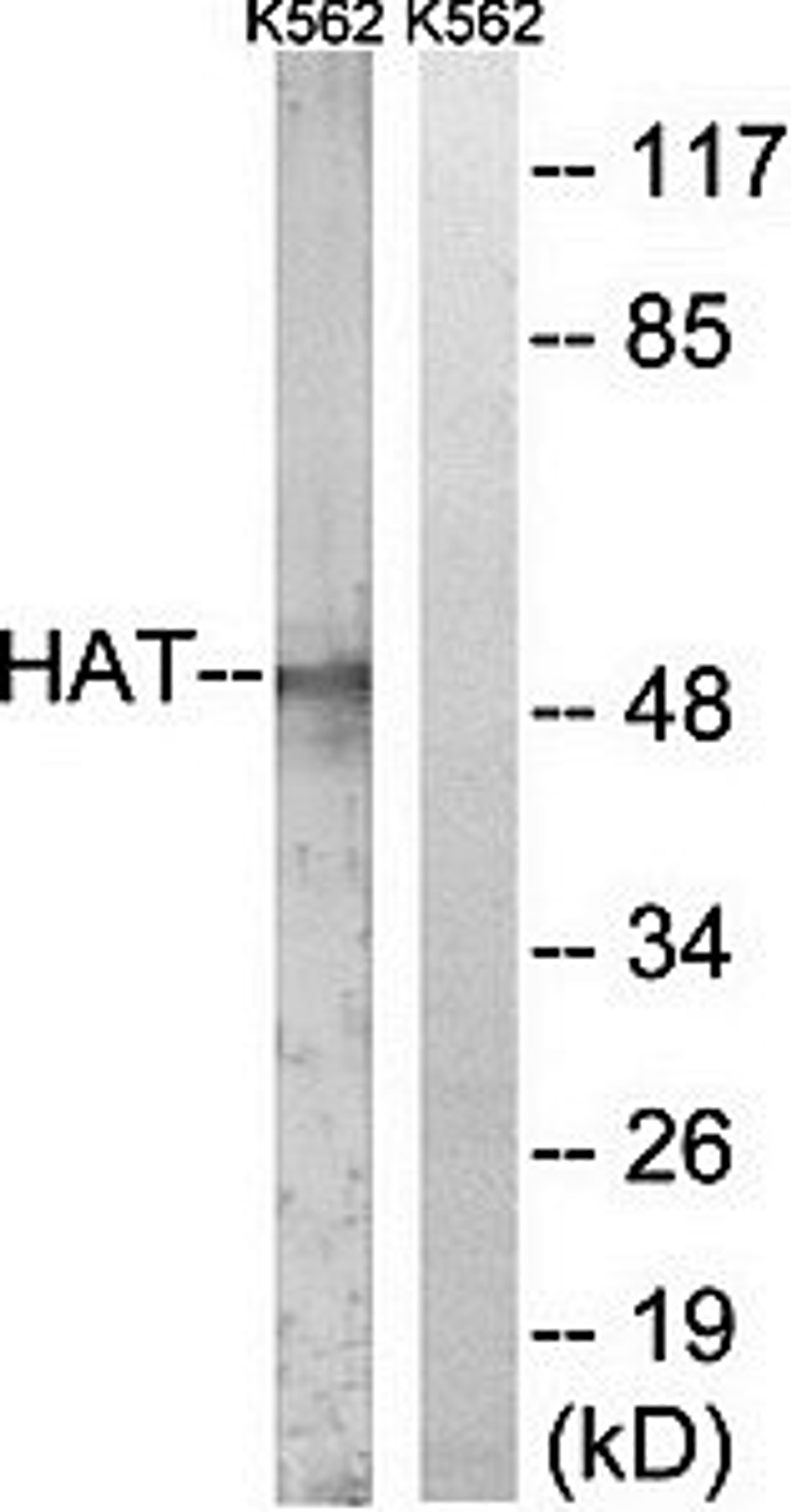 Western blot analysis of extracts from LOVO cells using HAT antibody (right lane: addition of synthetic peptide)