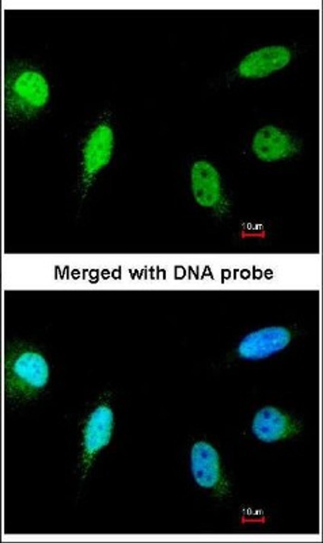 Immunocytochemistry/Immunofluorescence: Calcineurin A Antibody [NBP1-33041] - Analysis of paraformaldehyde-fixed HeLa, using NBP1-33041.