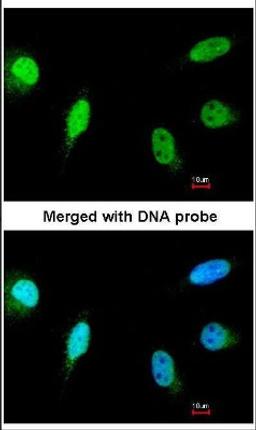 Immunocytochemistry/Immunofluorescence: Calcineurin A Antibody [NBP1-33041] - Analysis of paraformaldehyde-fixed HeLa, using NBP1-33041.