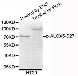 Western blot analysis of extracts of HT29 cells using ALOX5 (Phospho-S271) antibody