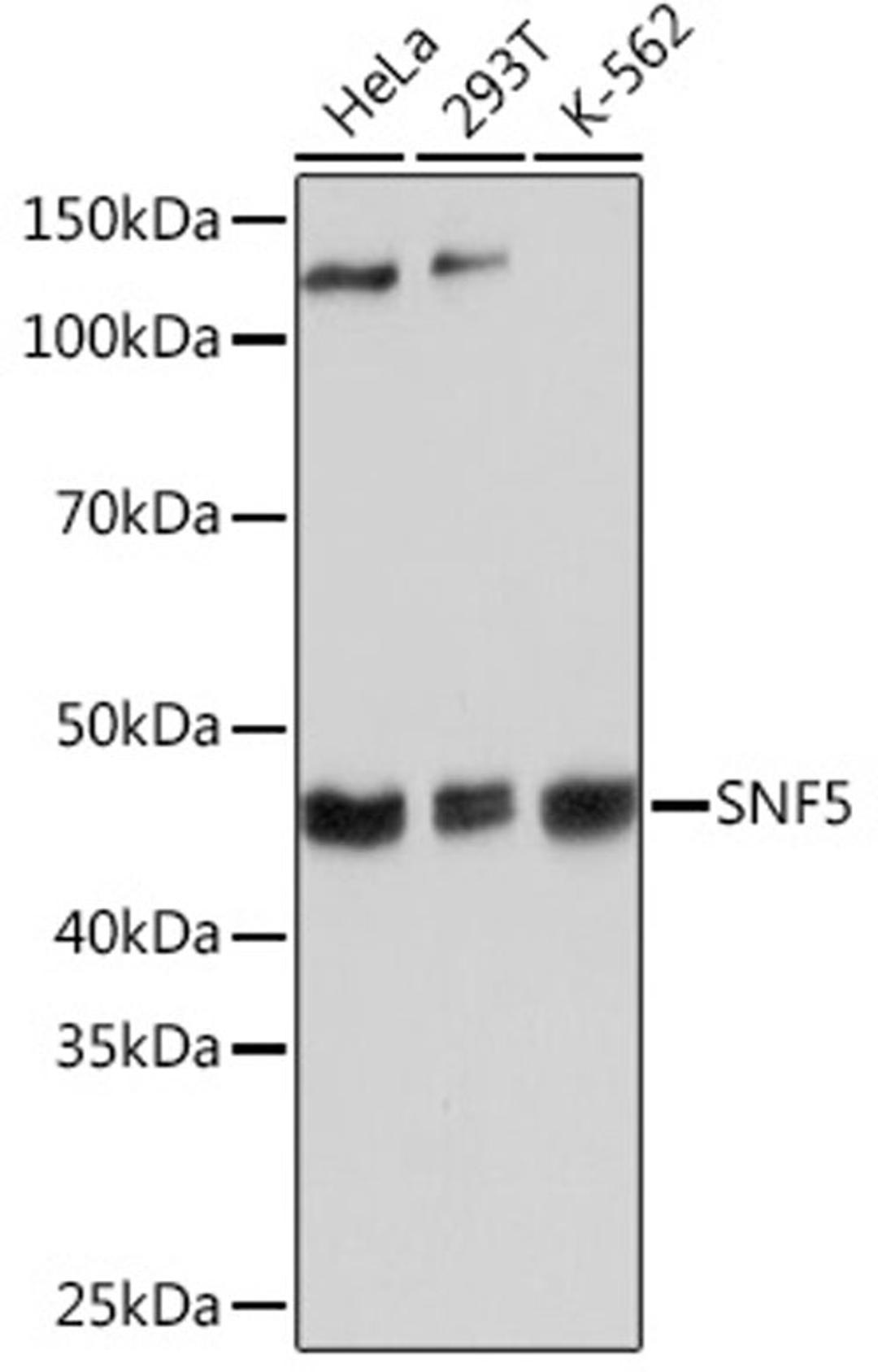 Western blot - SNF5 Rabbit mAb (A3247)