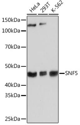 Western blot - SNF5 Rabbit mAb (A3247)