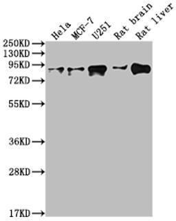 Western Blot. Positive WB detected in: Hela whole cell lysate, MCF-7 whole cell lysate, U251 whole cell lysate, Rat brain tissue, Rat liver tissue. All lanes: VCP antibody at 1:2000. Secondary. Goat polyclonal to rabbit IgG at 1/50000 dilution. Predicted band size: 90 kDa. Observed band size: 90 kDa. 