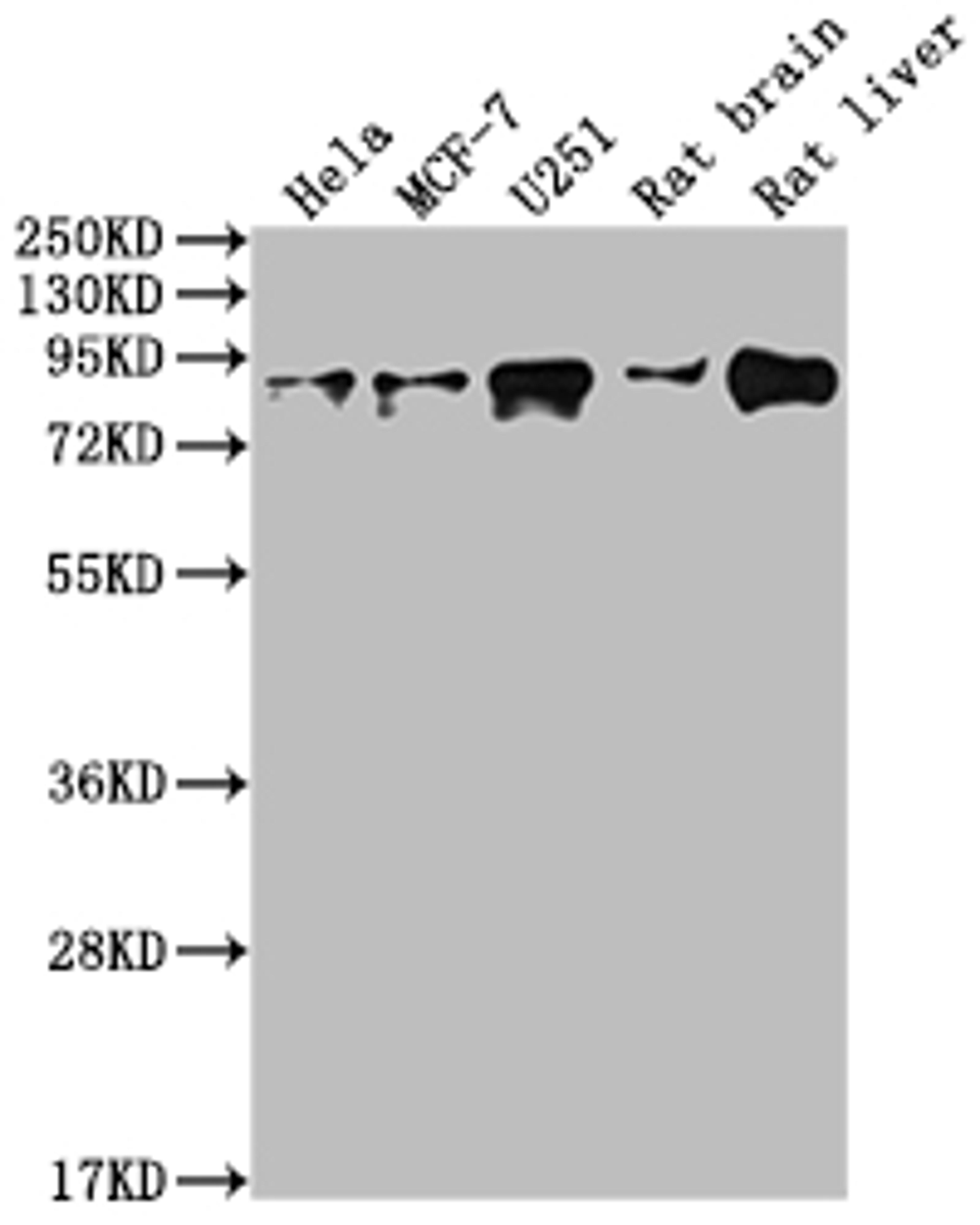 Western Blot. Positive WB detected in: Hela whole cell lysate, MCF-7 whole cell lysate, U251 whole cell lysate, Rat brain tissue, Rat liver tissue. All lanes: VCP antibody at 1:2000. Secondary. Goat polyclonal to rabbit IgG at 1/50000 dilution. Predicted band size: 90 kDa. Observed band size: 90 kDa. 