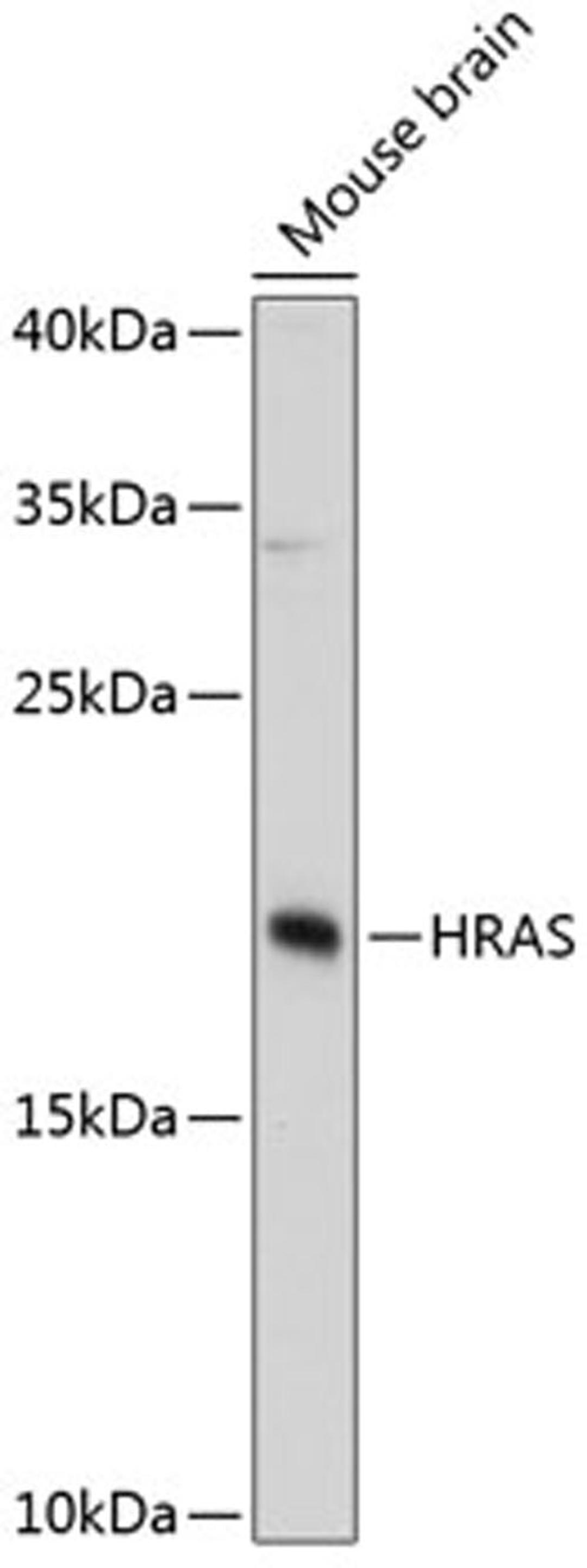 Western blot - HRAS Antibody (A12212)