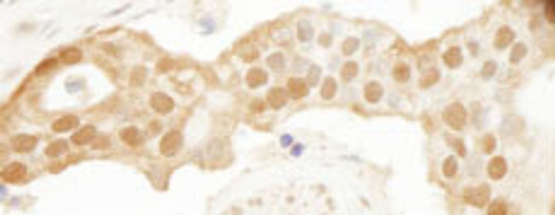 Detection of human DJ-1 by immunohistochemistry.