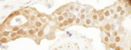 Detection of human DJ-1 by immunohistochemistry.