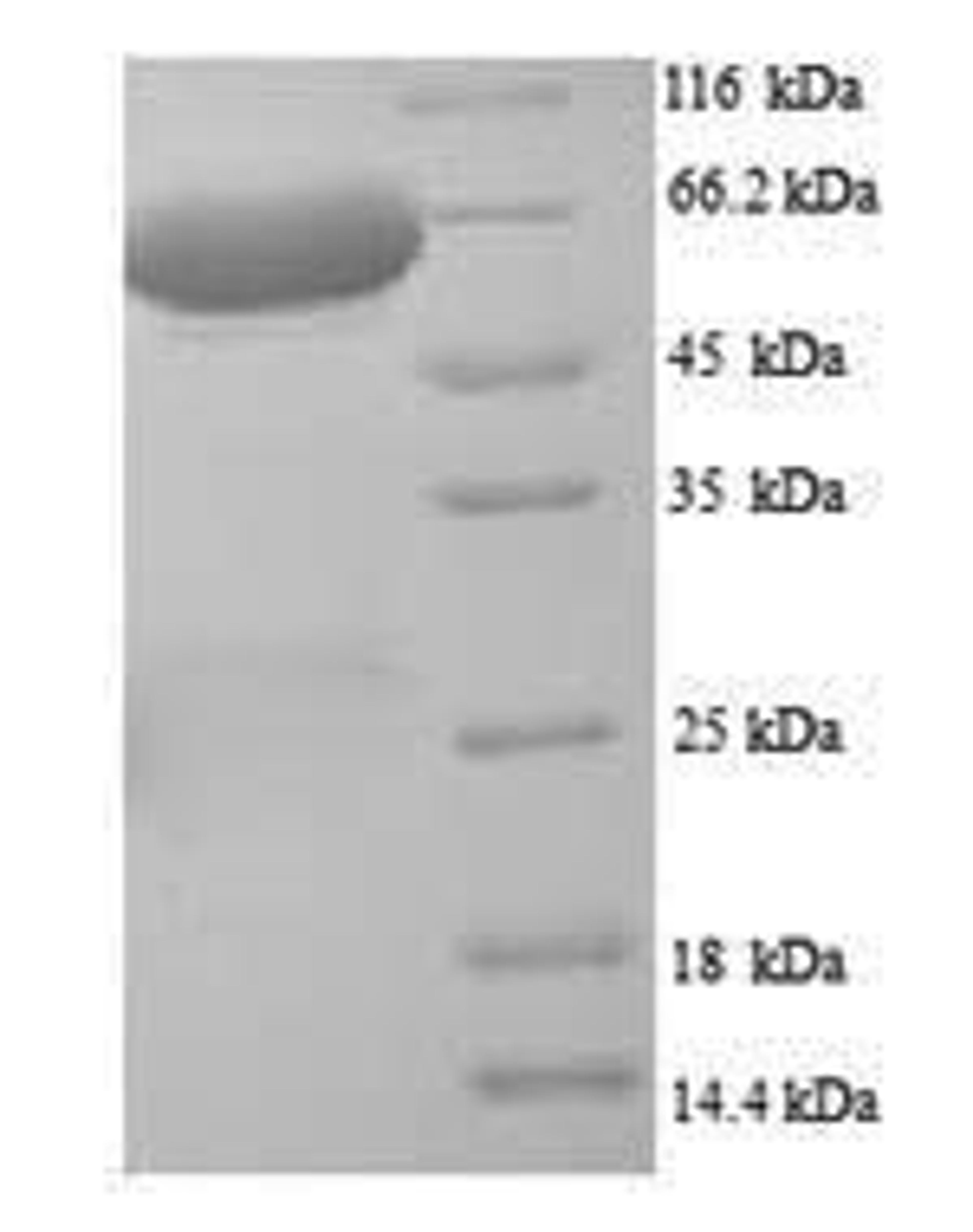 (Tris-Glycine gel) Discontinuous SDS-PAGE (reduced) with 5% enrichment gel and 15% separation gel.