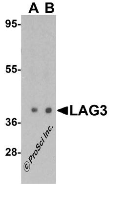 Western blot analysis of LAG3 in human liver tissue lysate with LAG3 antibody at (A) 1 and (B) 2 μg/mL