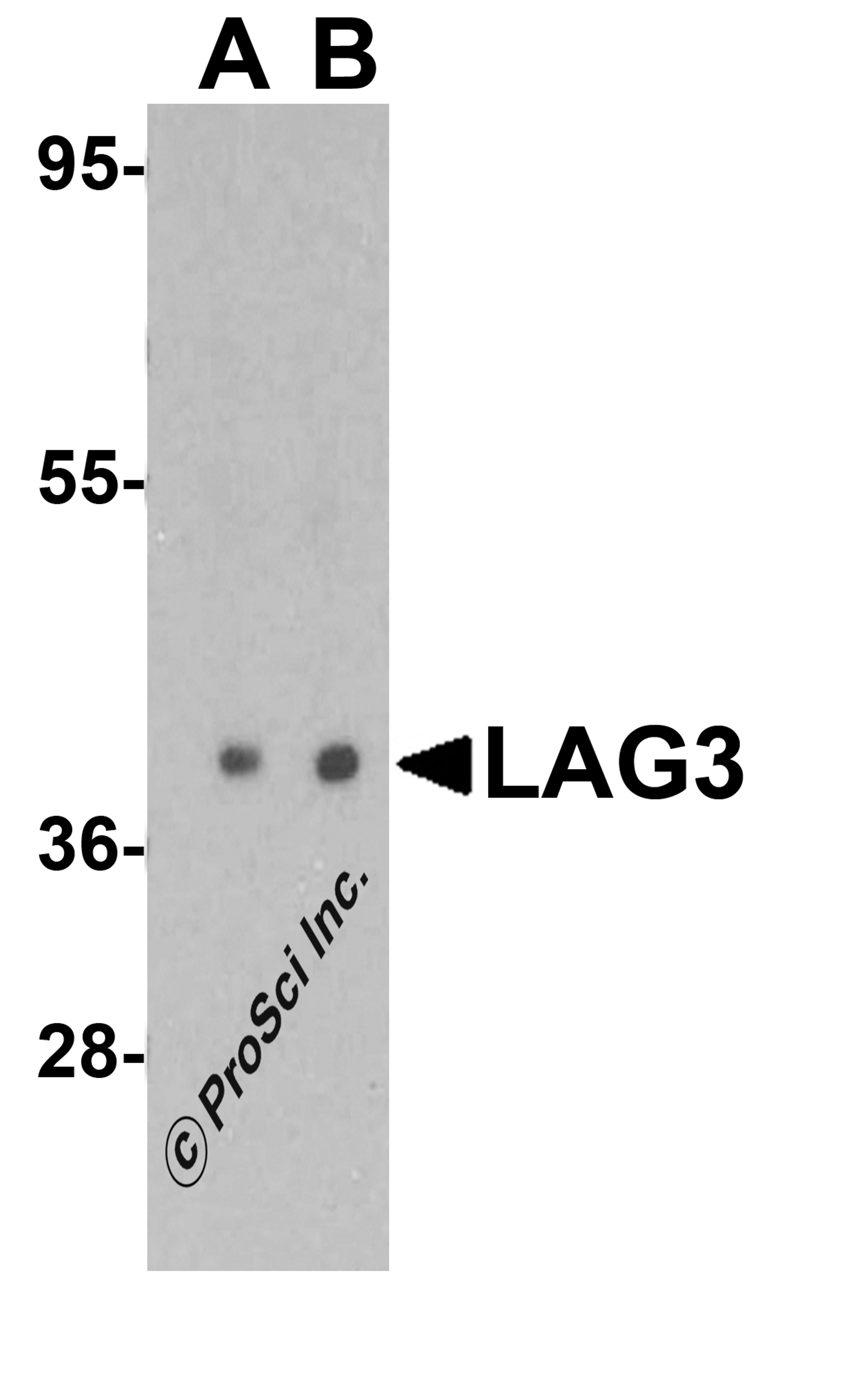 Western blot analysis of LAG3 in human liver tissue lysate with LAG3 antibody at (A) 1 and (B) 2 μg/mL