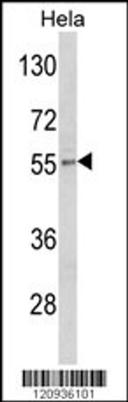 Western blot analysis of DFNA5 Antibody in Hela cell line lysates (35ug/lane)