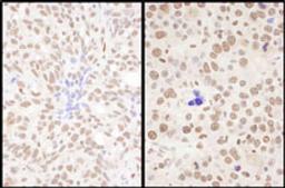 Detection of human and mouse SRSF7 by immunohistochemistry.