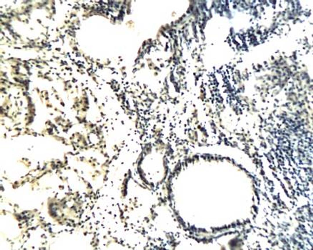 Immunohistochemical analysis of paraffin-embedded bronchial pulmonary tissues in rats using Collagen III antibody 