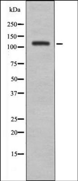 Western blot analysis of UV treated A2780 whole cell lysates using EPHA8 -Phospho-Tyr838- antibody