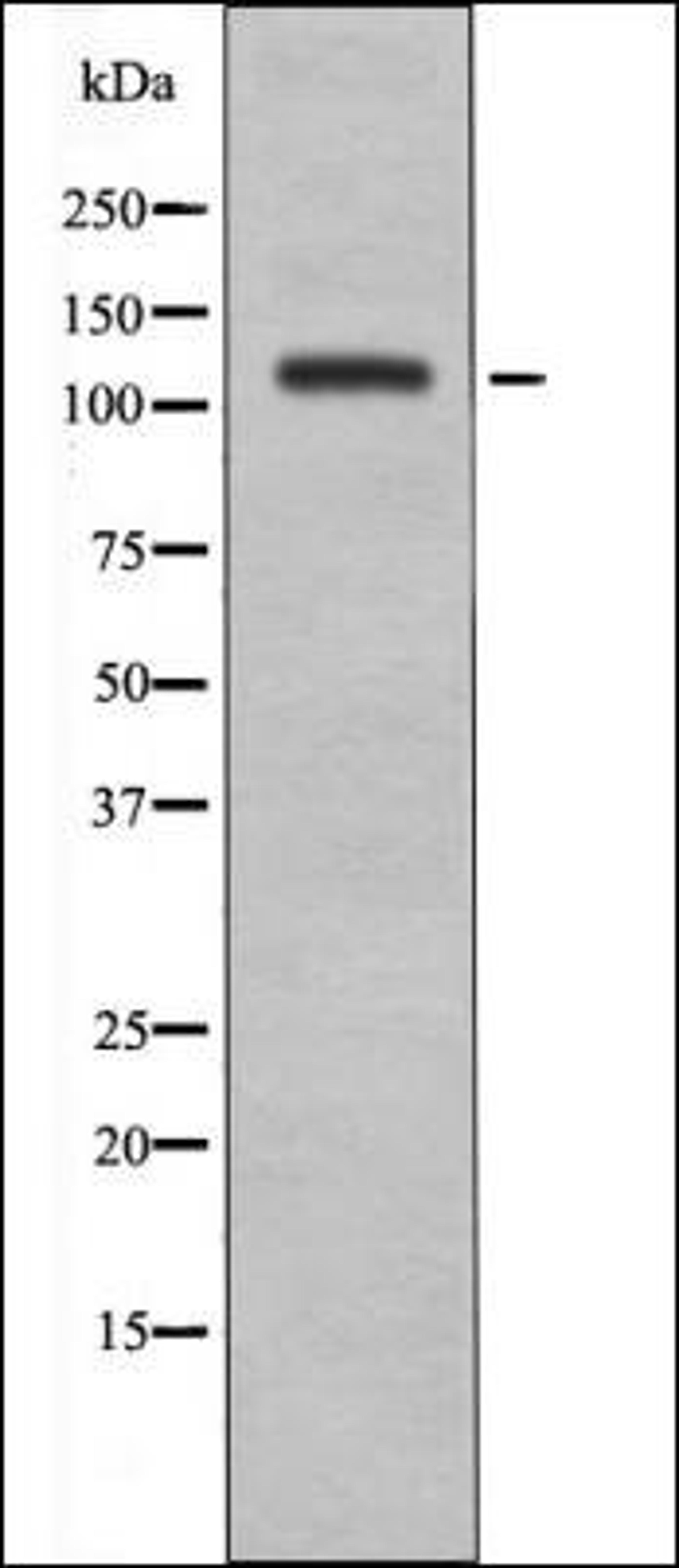 Western blot analysis of UV treated A2780 whole cell lysates using EPHA8 -Phospho-Tyr838- antibody