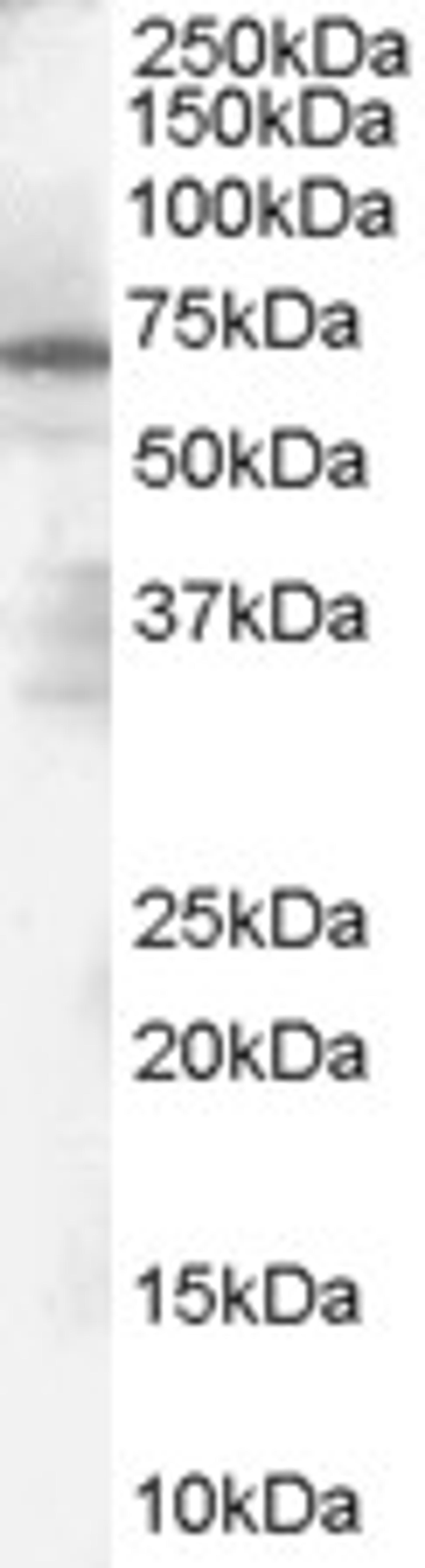 46-134 (1ug/ml) staining of Human Spleen Lysate (35ug protein in RIPA buffer). Primary incubation was 1 hour. Detected by chemiluminescence.