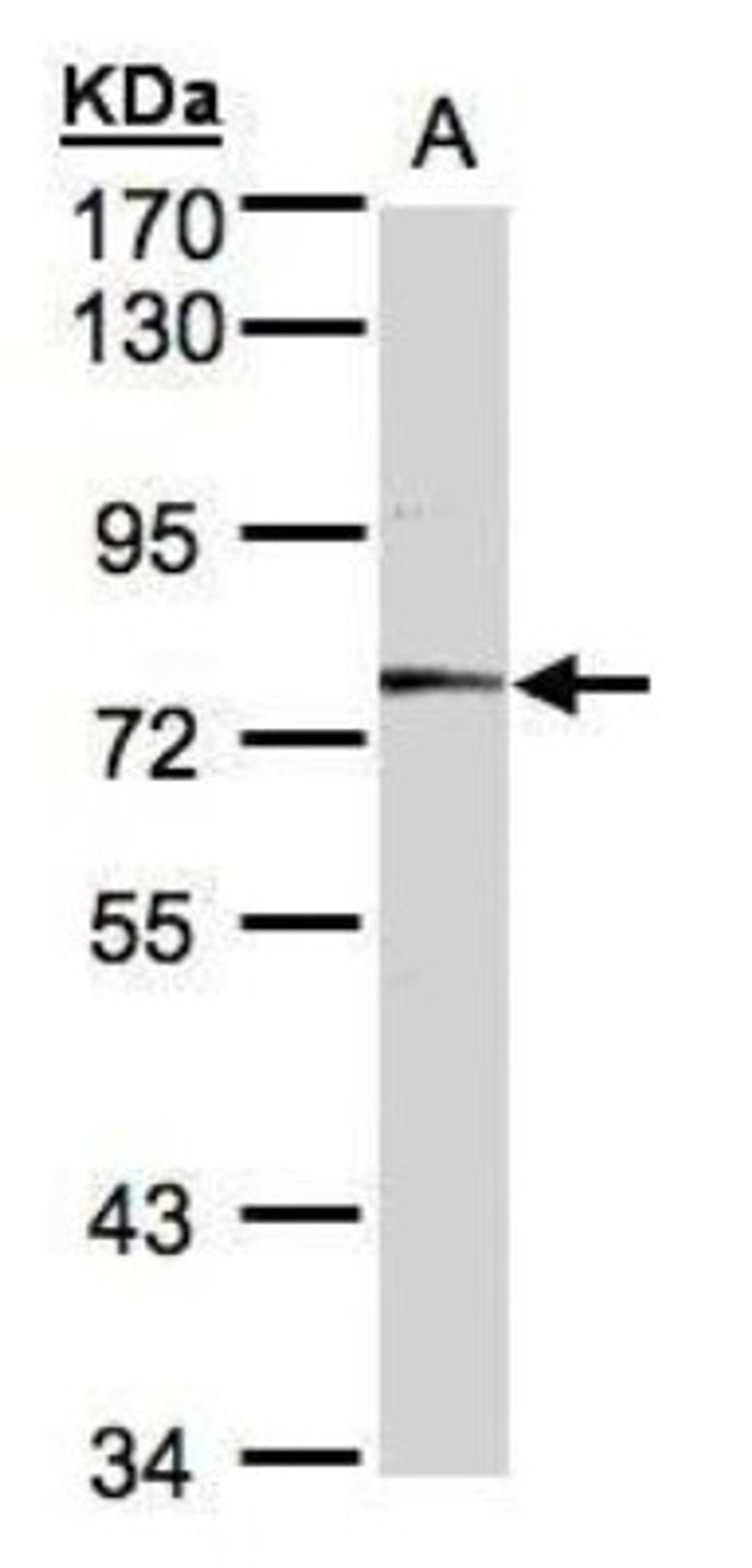 Western Blot: Meprin alpha Antibody [NBP1-32595] - (30 ug whole cell lysate) A431 7.5% SDS PAGE; antibody diluted at 1:1000