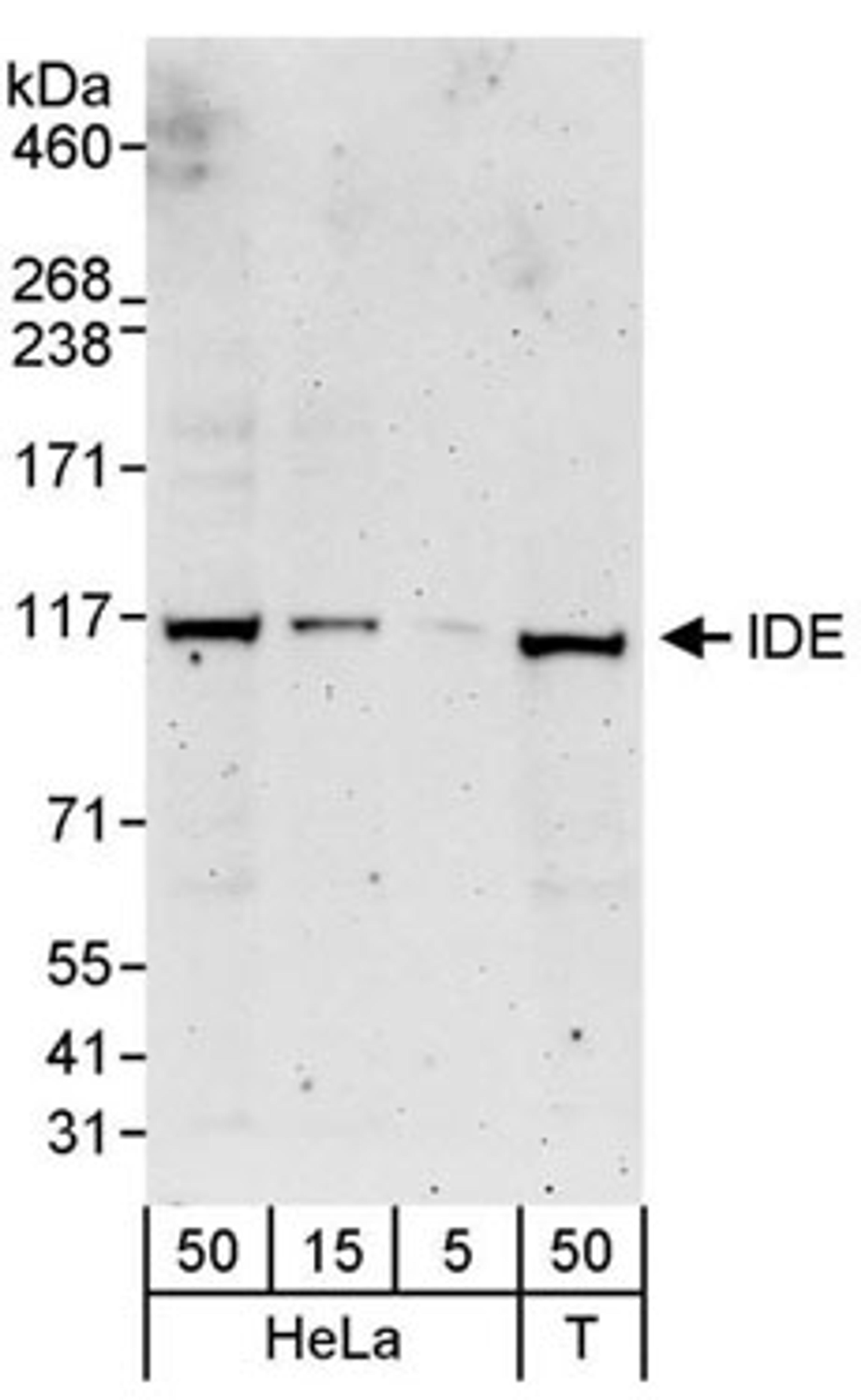 Detection of human IDE by western blot.