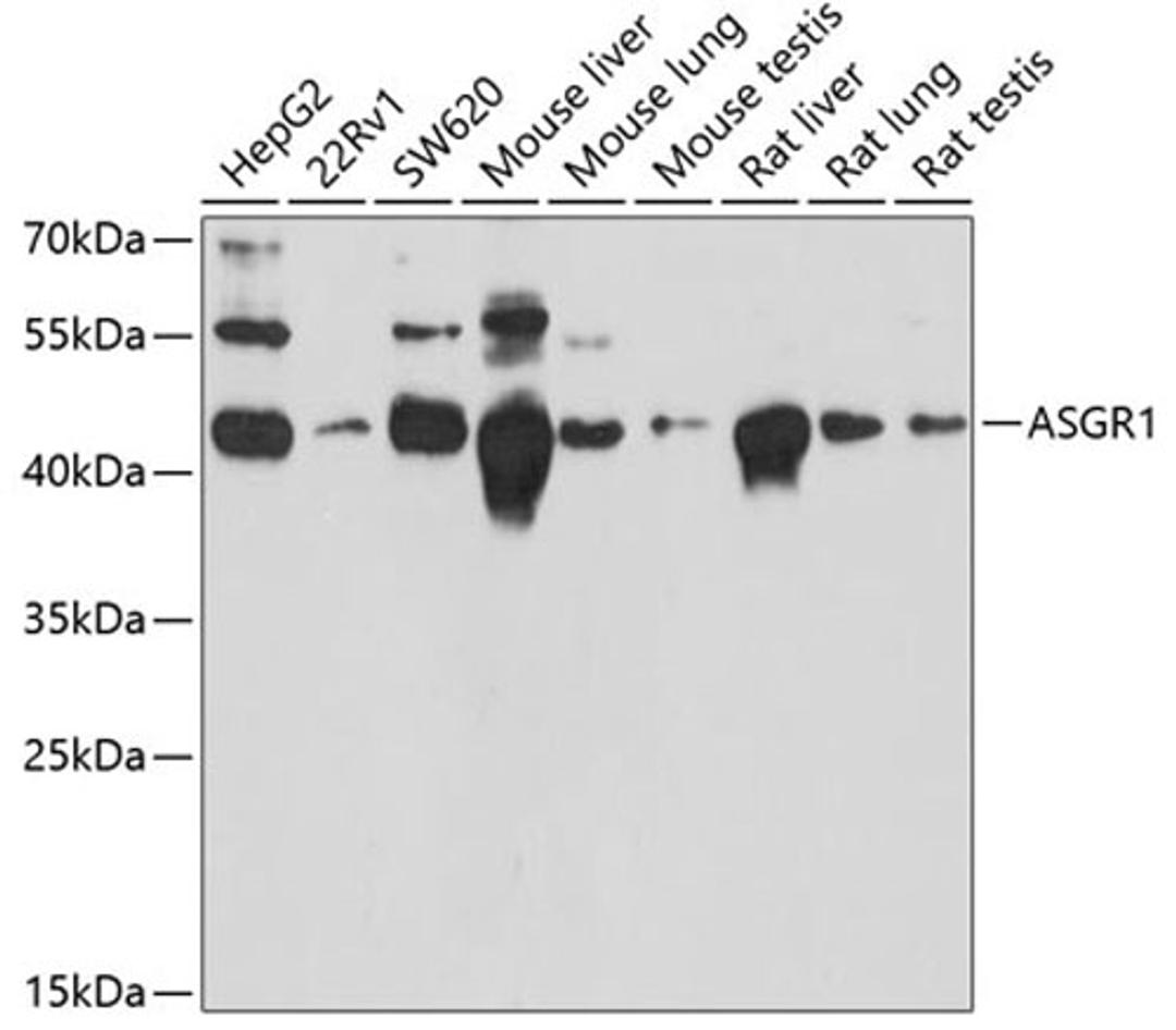 Western blot - ASGR1 antibody (A13279)