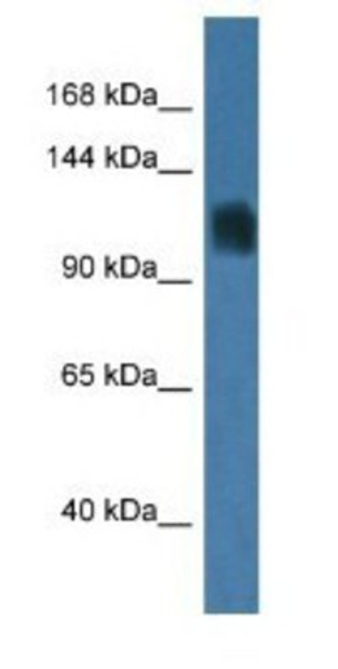 Western Blot: RAG1 Antibody [NBP1-74190] - Mouse Liver Lysate 1ug/ml Gel Concentration 6-18%