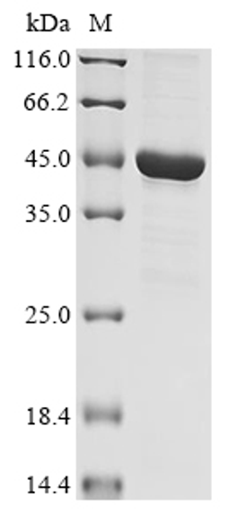 (Tris-Glycine gel) Discontinuous SDS-PAGE (reduced) with 5% enrichment gel and 15% separation gel.