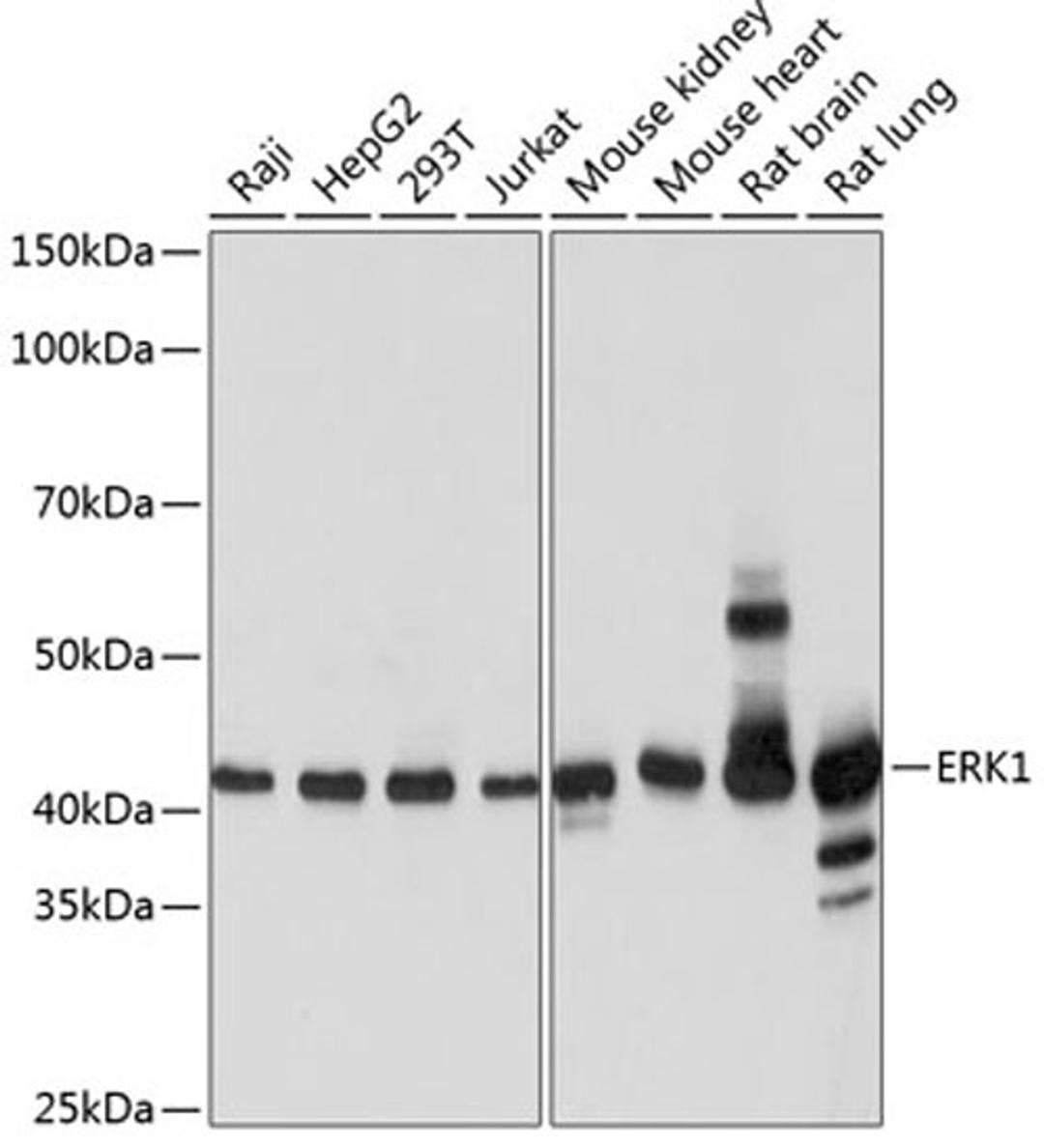 Western blot - ERK1 antibody (A19561)