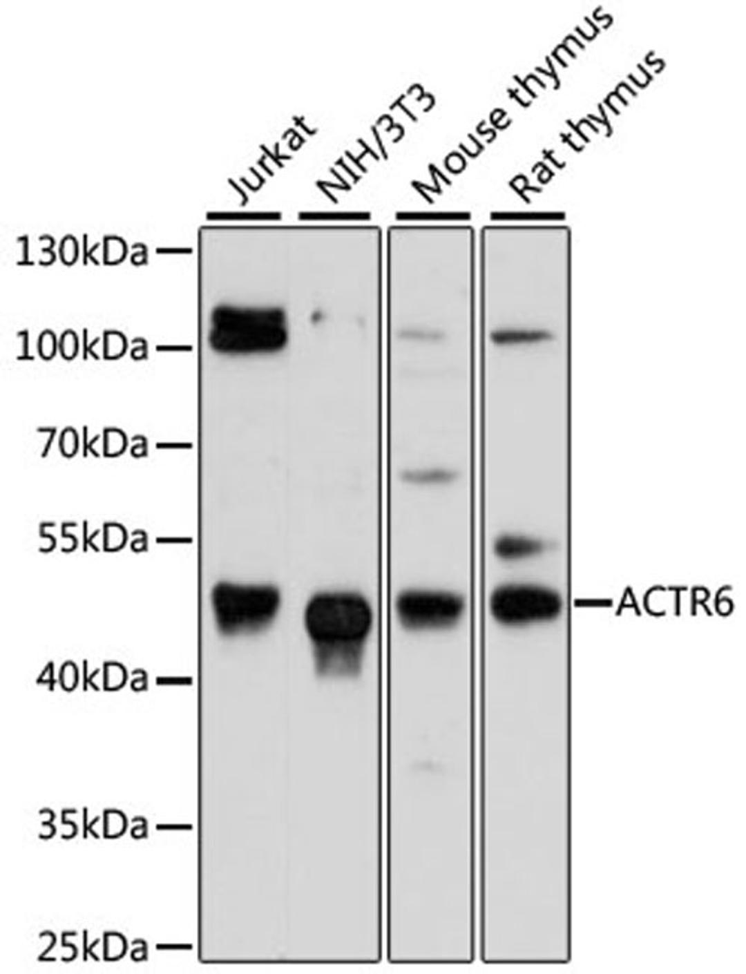 Western blot - ACTR6 antibody (A13227)