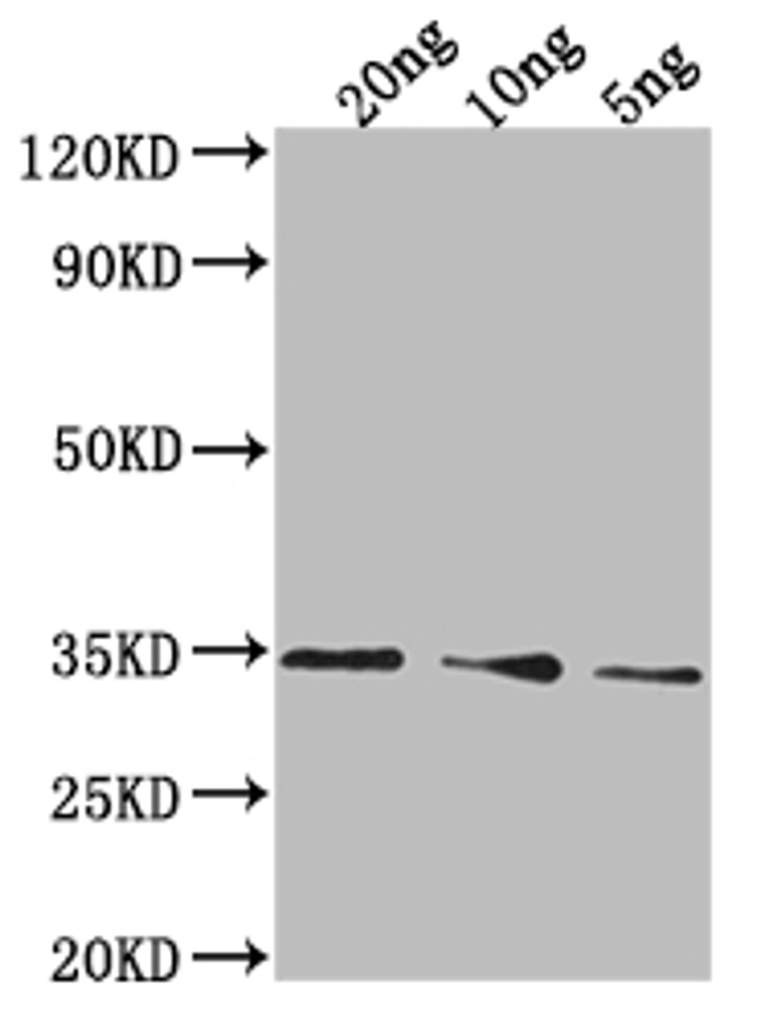 Western Blot. Positive WB detected in Recombinant protein. All lanes: PDAT1 antibody at 1:2000. Secondary. Goat polyclonal to rabbit IgG at 1/50000 dilution. Predicted band size: 26.5 kDa. Observed band size: 35 kDa. 