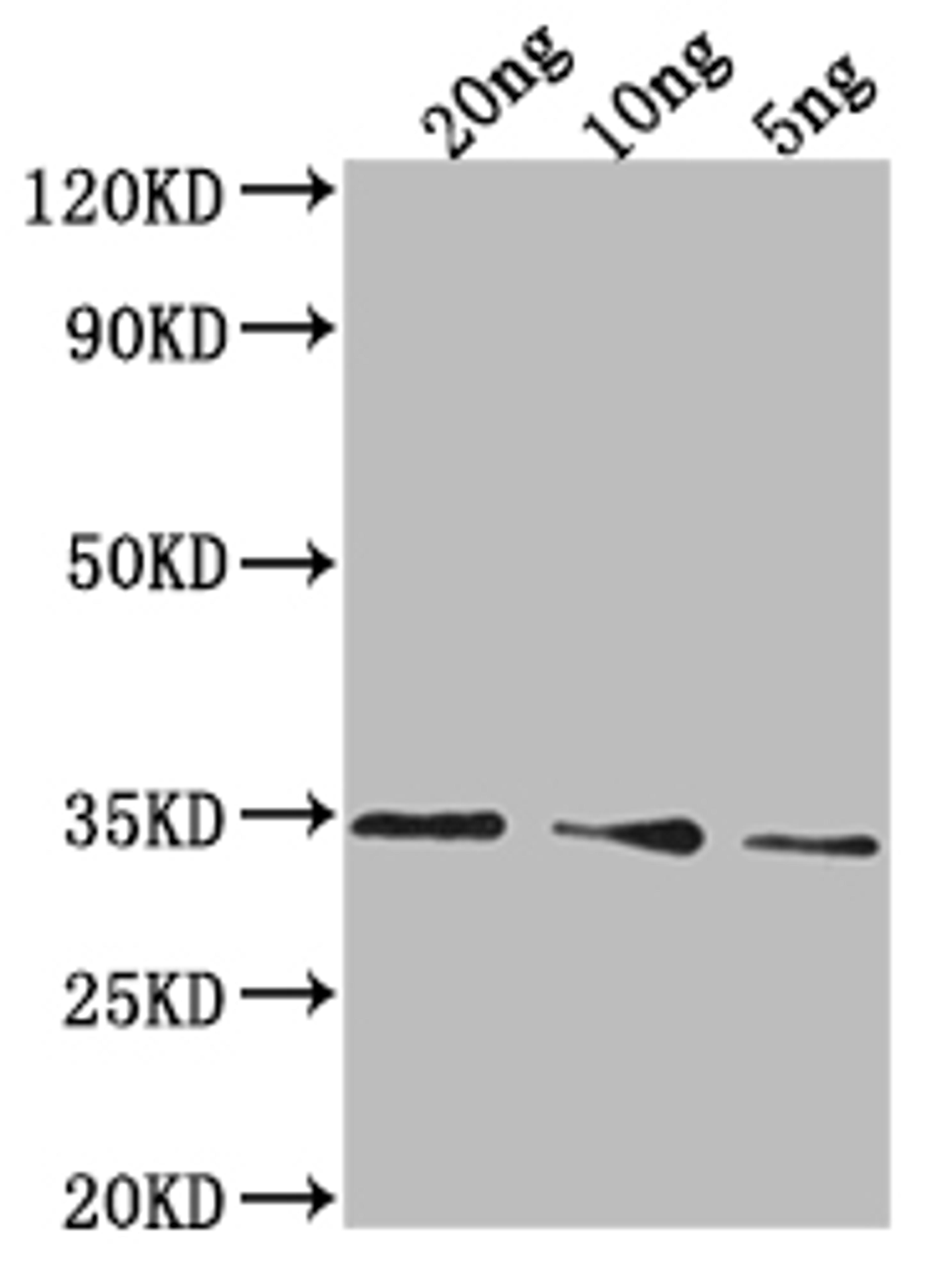 Western Blot. Positive WB detected in Recombinant protein. All lanes: PDAT1 antibody at 1:2000. Secondary. Goat polyclonal to rabbit IgG at 1/50000 dilution. Predicted band size: 26.5 kDa. Observed band size: 35 kDa. 