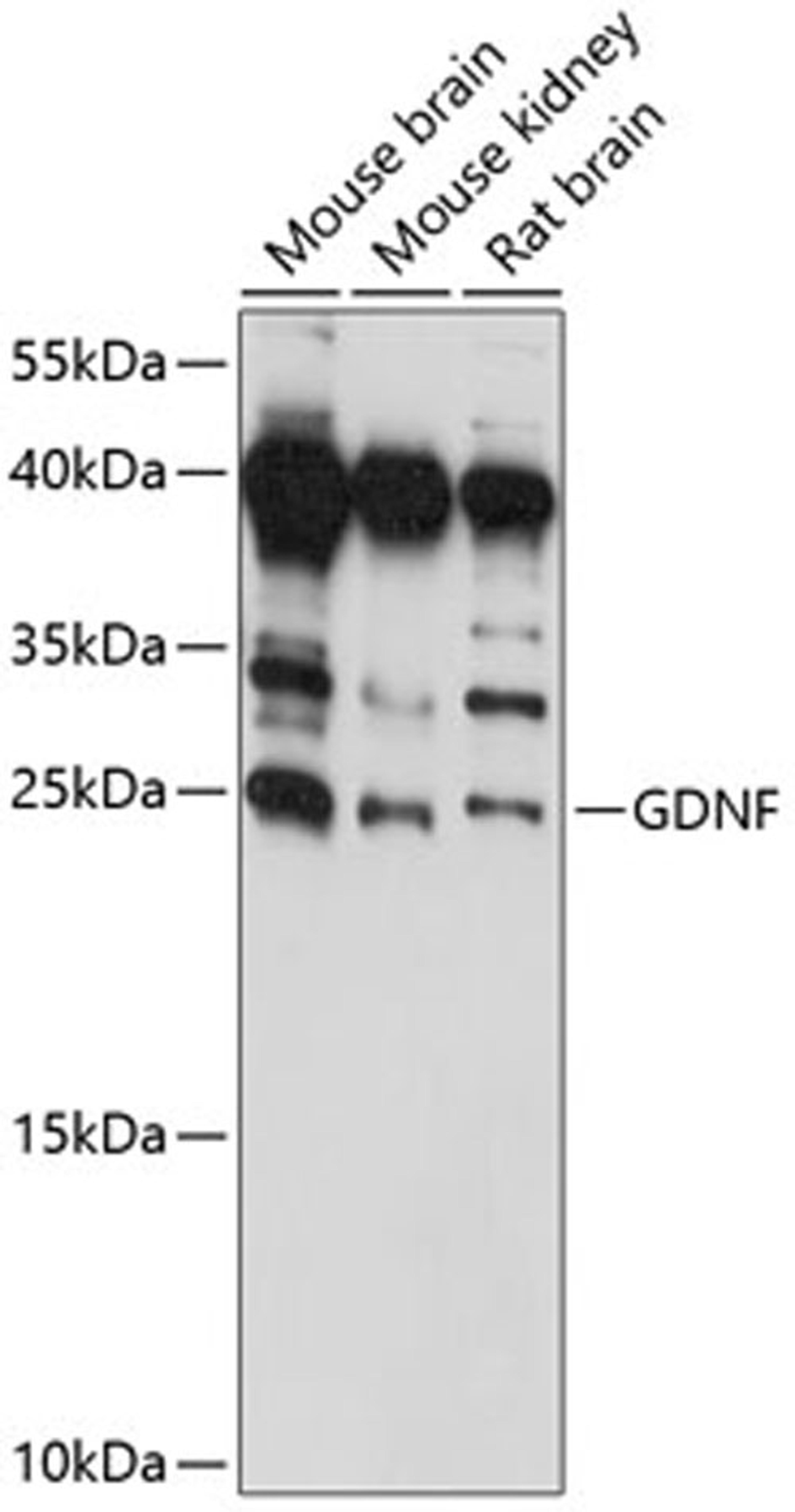 Western blot - GDNF antibody (A14639)