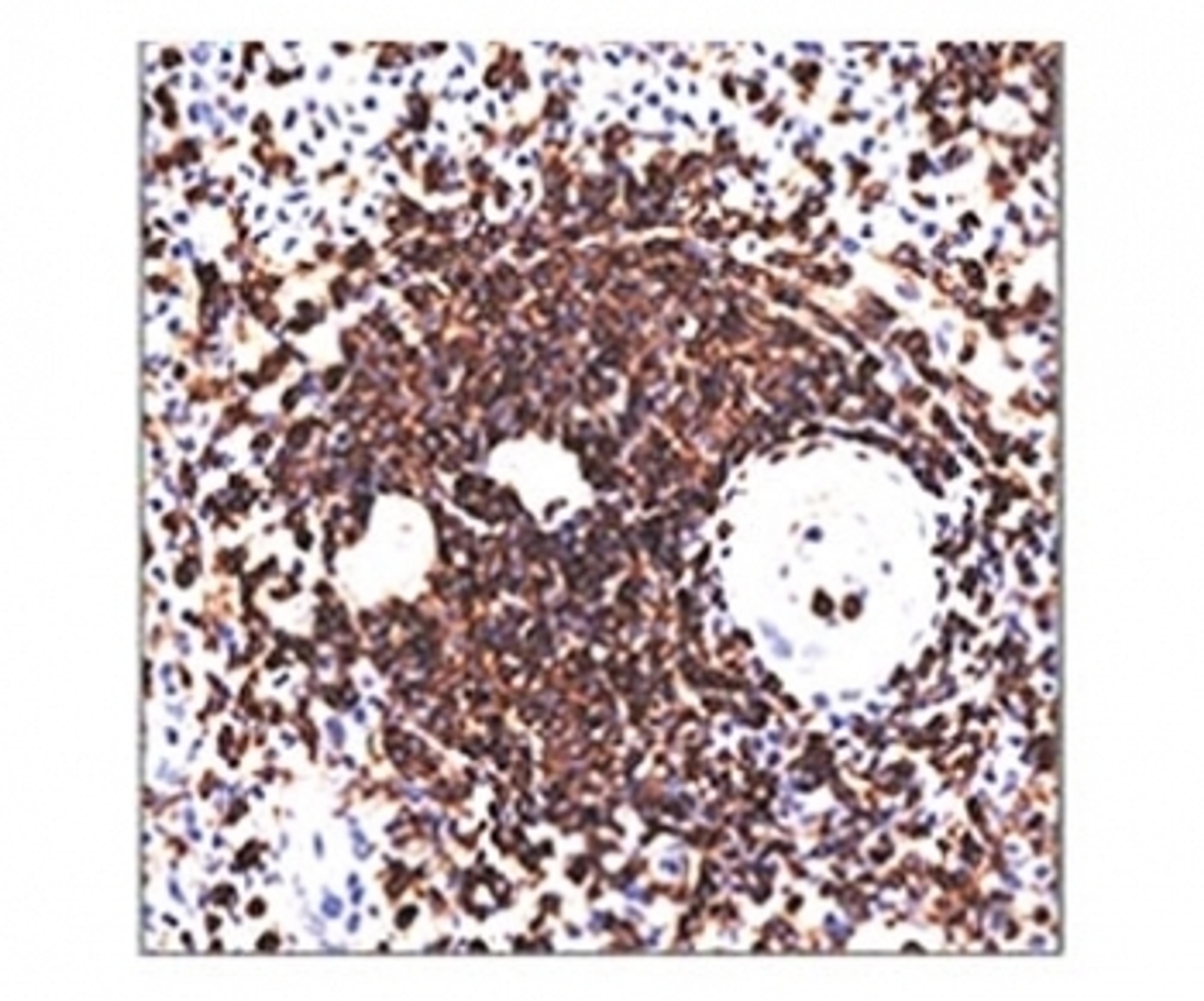 IHC testing of human spleen stained with 158-4D3 mAb.