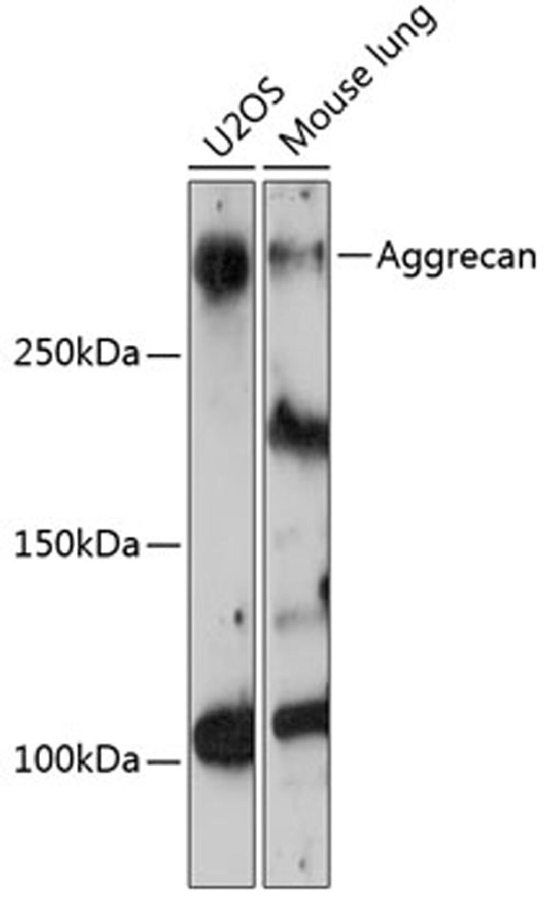 Western blot - Aggrecan Rabbit mAb (A11691)