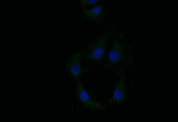 Immunofluorescence staining of A549 with CSB-RA788545A0HU at 1:10, counter-stained with DAPI. The cells were fixed in 4% formaldehyde and blocked in 10% normal Goat Serum. The cells were then incubated with the antibody overnight at 4°C. The secondary antibody was Alexa Fluor 519-congugated AffiniPure Goat Anti-Rabbit IgG(H+L).